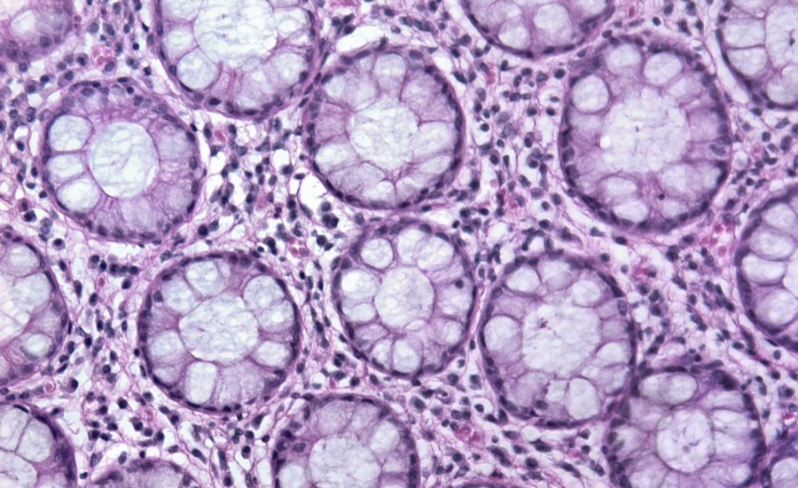 microscope image of human glandular tissue