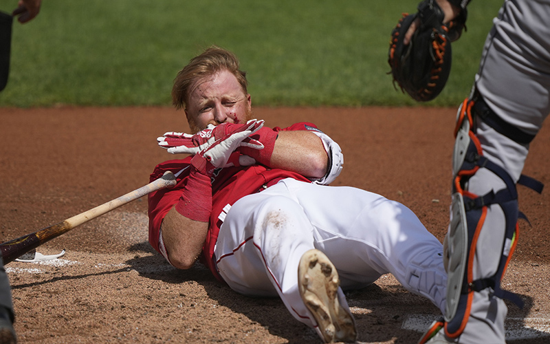 Boston Red Sox player Justin Turner reacts after being hit in the face on a pitch