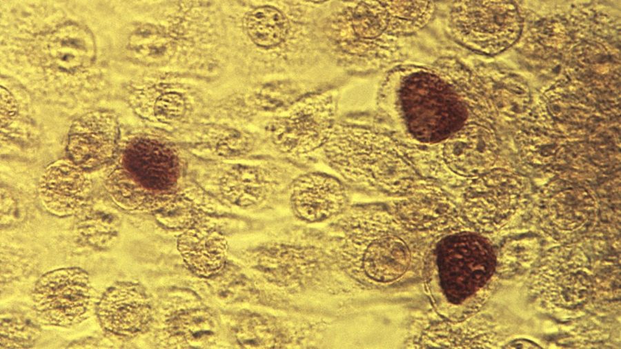 This microscope image shows chlamydia trachomatis bacteria.