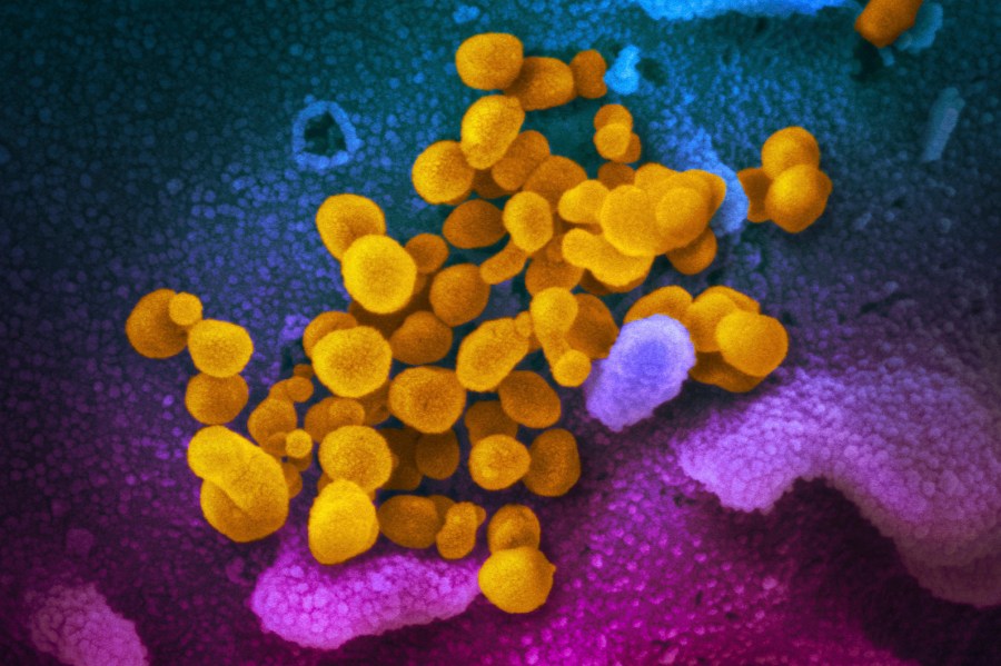 FILE - This undated, colorized electron microscope image made available by the U.S. National Institutes of Health in February 2020 shows the Novel Coronavirus SARS-CoV-2, indicated in yellow, emerging from the surface of cells, indicated in blue/pink, cultured in a laboratory.