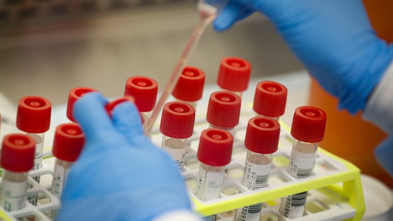 FILE - In this Wednesday, March 11, 2020 file photo, a technician prepares COVID-19 coronavirus patient samples for testing at a laboratory in New York's Long Island. Confidence in the scientific community declined among U.S. adults in 2022, a major survey shows, driven by a a partisan divide that emerged during the COVID-19 pandemic. (AP Photo/John Minchillo, File)