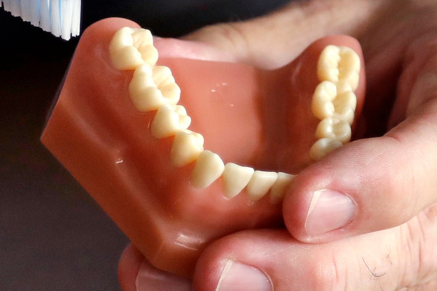 FILE - A dentist holds a model of teeth in Seattle. (AP Photo/Elaine Thompson, File)